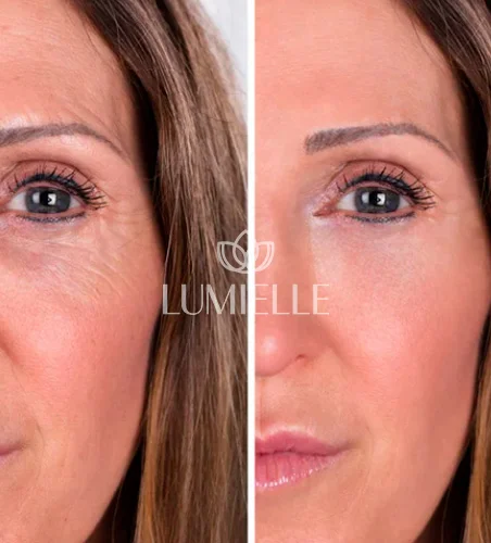 LUMIELLE-PRV-7.webp
