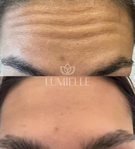 LUMIELLE PRV 9